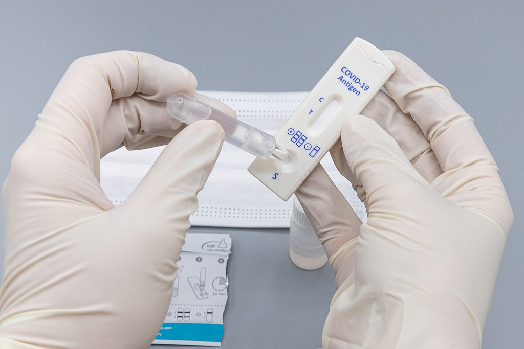 Testare rapida antigen COVID19 la cabinet